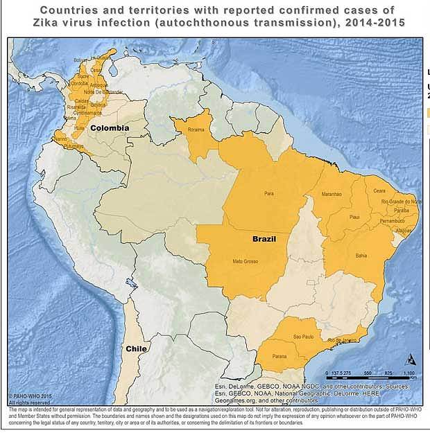 microcephaly