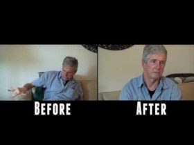 Parkinson’s