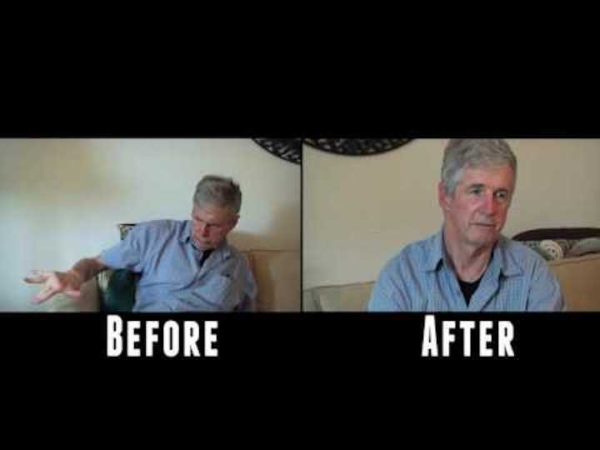 Parkinson’s