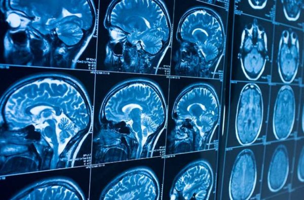 Endocannabinoid System