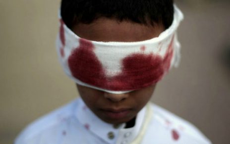 Yemen