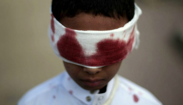 Yemen