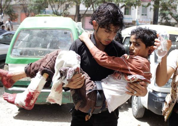 Yemenis