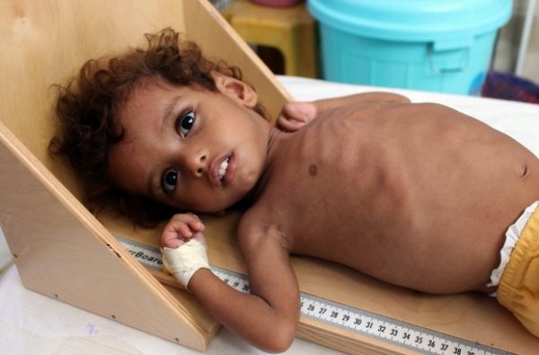 Yemen