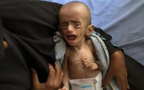 Yemen