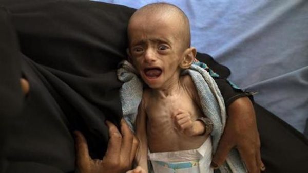Yemen