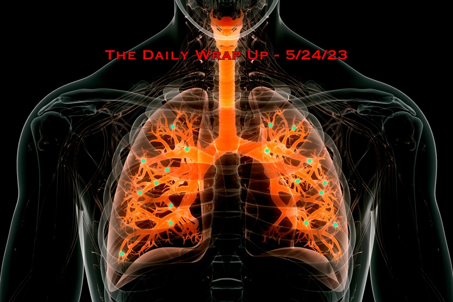 The Daily Wrap Up